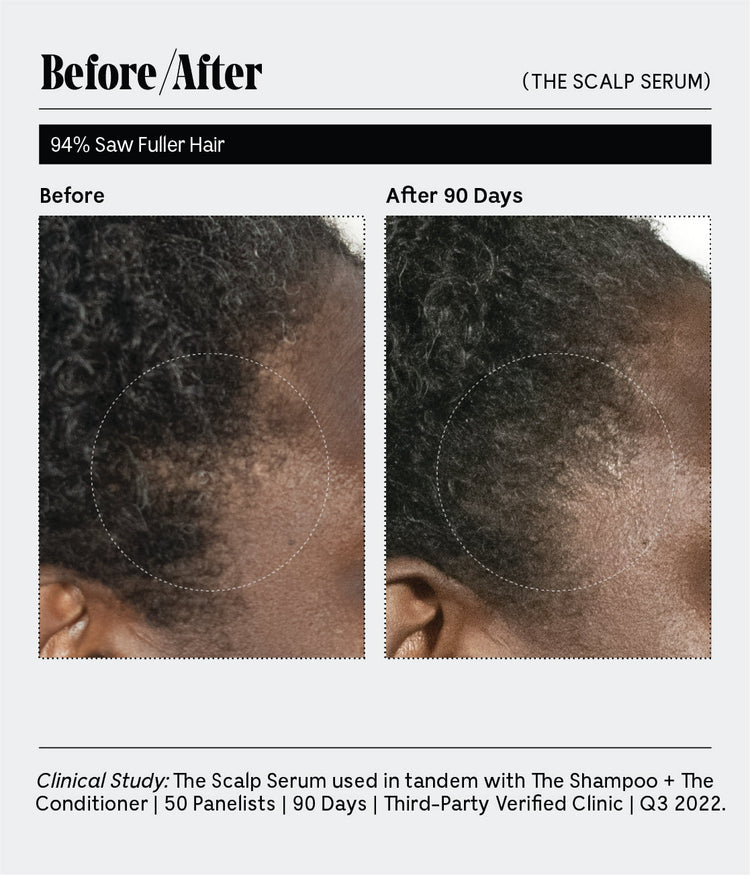 The Scalp Serum | 30-Day Supply | 5% Capixyl™