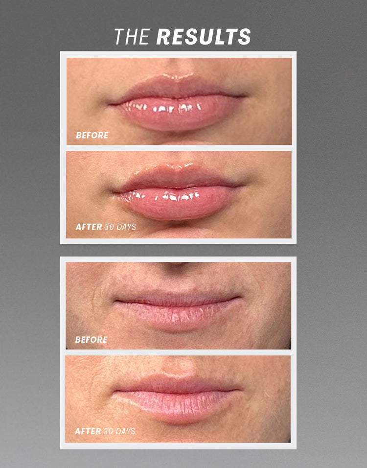 Lip Oasis Glossy Treatment in Clear