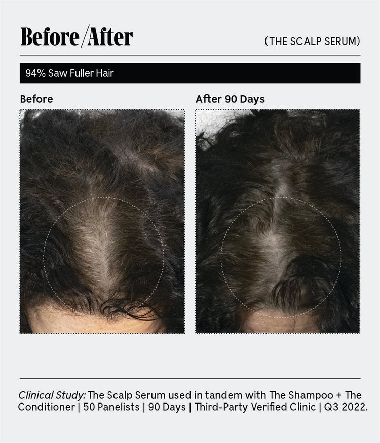 The Scalp Serum | 30-Day Supply | 5% Capixyl™